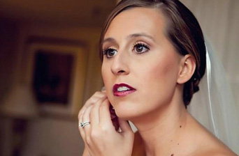 Cosmetic Bonding from Boston Dentist Dr. Jill Smith