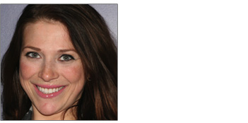 Complex Dental Reconstruction from Boston dentist Dr. Jill Smith