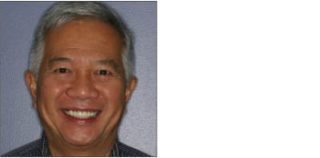 Repairing damage from Acid Reflux from Boston Dentist Dr. Jill Smith